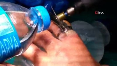 elektrik carpmasi -  - Şişen parmaklarında sıkışan yüzükleri itfaiye keserek çıkartabildi Videosu