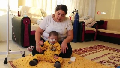 ameliyat -  Down sendromlu minik Efe sağlığına kavuşacağı günü bekliyor  Videosu