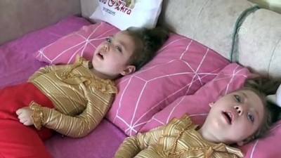 medikal - Hasta ikizlerin ailesi yardım bekliyor - KASTAMONU  Videosu