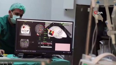 3 boyutlu goruntu -  Genç hemşireyi felç olmaktan kurtaran operasyon...Beyninde oluşan 'damar yumakçığı' yerli ve milli olan 3 boyutlu cihazlarla alındı  Videosu
