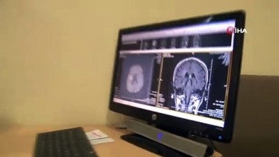 konusma bozuklugu -  Nöroloji Uzmanı Dr. Faik İlik: 'MS hastalığında erken teşhis önemli'  Videosu