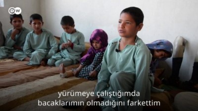 Savaşın ampüte çocukları