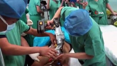 omurga -  - Çin’de İnşaat İşçisinin Vücuduna Saplanan Demir Çıkarıldı  Videosu