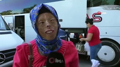 yolcu otobusu -  İHA'nın haberi ile Türkiye'nin gündemine oturan Leyla Demirci yüz nakli için Antalya'ya geldi  Videosu