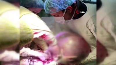 ameliyathane -  - Rusya’da Kadının Yumurtalıklarından 25 Kilogram Tümör Çıkarıldı  Videosu