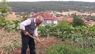 Yüzünü kaplayan dev tümörden kurtulmak istiyor - UŞAK 