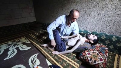 idlib - BAB - Esed rejiminin sakat ve evsiz bıraktığı Abdullah yardım bekliyor Videosu