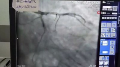  COVİD 19 hastasına stent takıldı
