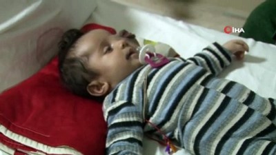  Suriyeli Yusuf bebek Türkiye’de tedavi ediliyor