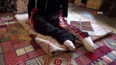 kaza kursunu -  Kaza kurşunuyla felç kalan 16 yaşındaki genç kız, yürümek için destek bekliyor Videosu