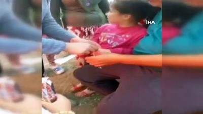 kucuk kiz -  İstanbul’da parmağını sıkıştıran küçük kıza maket bıçaklı müdahale Videosu