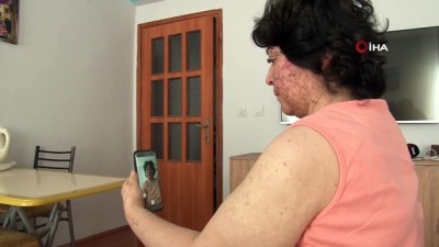kemoterapi -  Artık telefondaki filtreler bile yüzü için yetersiz kalıyor Videosu