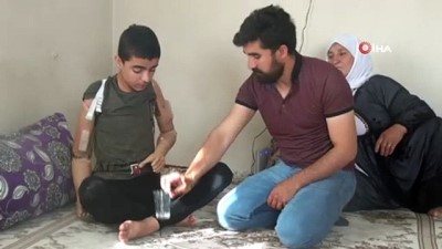 ayak parmaklari -  Devletin şefkatli eliyle 'kollarına' kavuştu Videosu