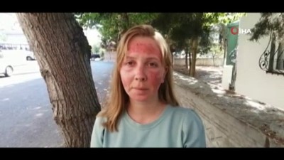 cilt bakimi -  Cilt bakımı yaptıran kadının hayatı karardı Videosu