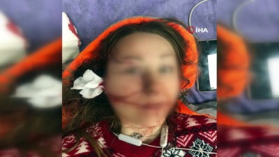 kiskanclik -  Falçatalı saldırıya uğrayan kadın ile ilgili emniyetten açıklama Videosu