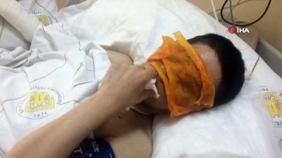 silahli saldiri -  Eniştesinin saldırısı sonucu ağır yaralandı, yüzü tanınmayacak hale geldi Videosu