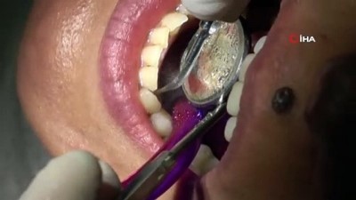sosyal medya -  Dişleri beyazlatmada sosyal medya önerileri sağlığınıza zarar verebilir Videosu