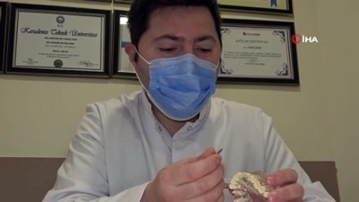 cene kemigi -  'Kayıp dişleriniz için implant tedavisi tercih edin' Videosu