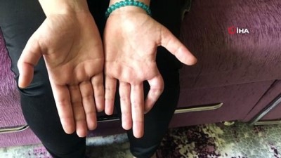 yardim talebi -  Genç kız yeniden elini tam kullanabilmenin umuduyla yaşıyor Videosu