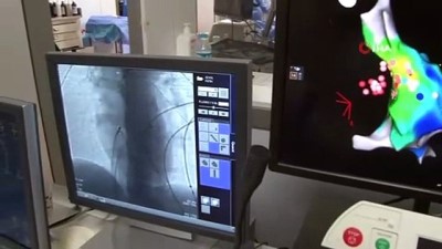 kalp yetmezligi -  Kardiyoloji uzmanı açıkladı: Kalpte aritmi çözümsüz değil Videosu
