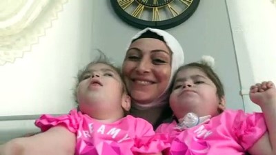 tek yumurta ikizi - ANTALYA - Mutluluklarının adı Serebral Palsi hastası tek yumurta ikizi kızları oldu Videosu