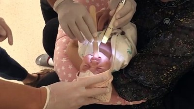 bebek - UŞAK - Dil kökü geride doğan bebek, uygulanan tedaviyle beslenmeye başladı Videosu